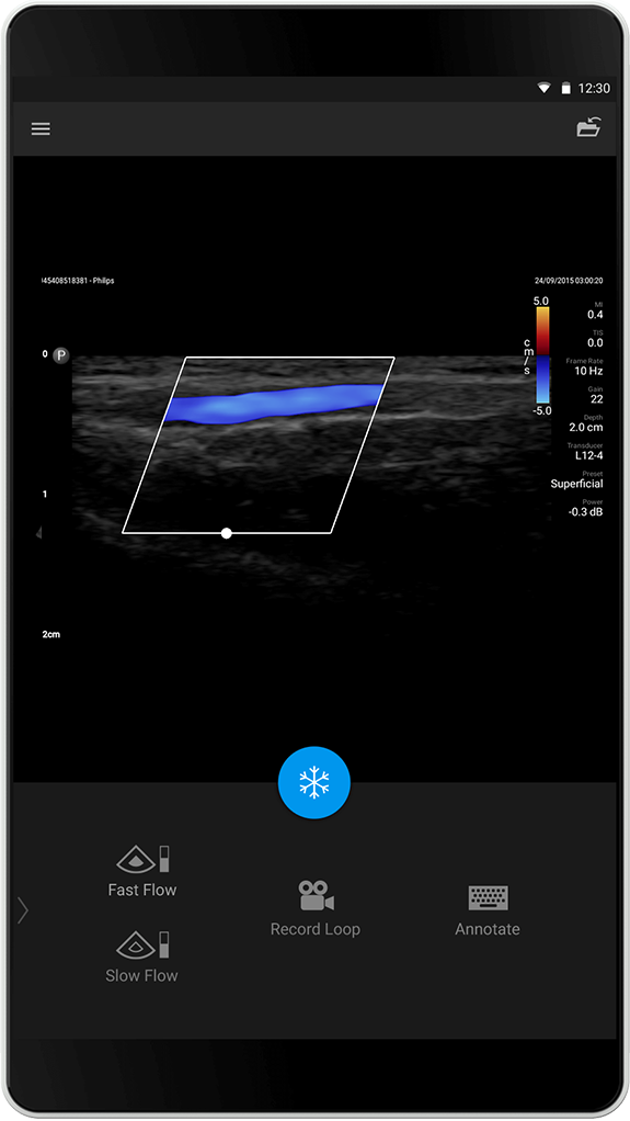 Superficial Exam (Overfladisk unders&oslash;kelse)