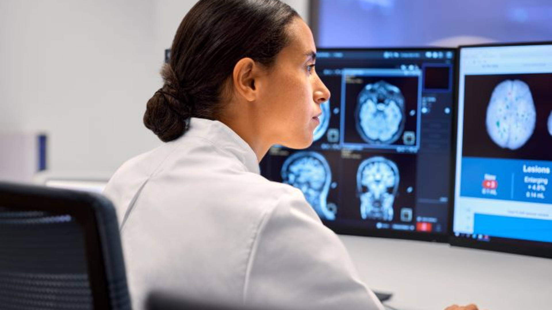 Philips AI Manager n&aring; tilgjengelig i hele Norge